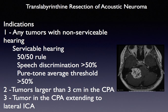 Translab Resection